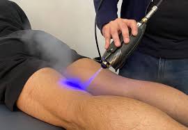 Targeted cryotherapy on legs Body Reset Recovery Clinton Maryland